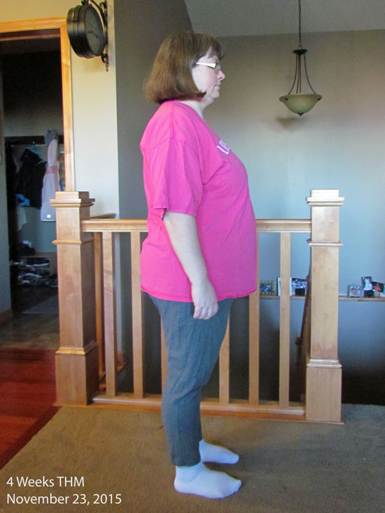 After 1 month side - 11/23/15