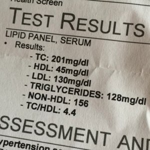 CVS lipid panel test reusults photo